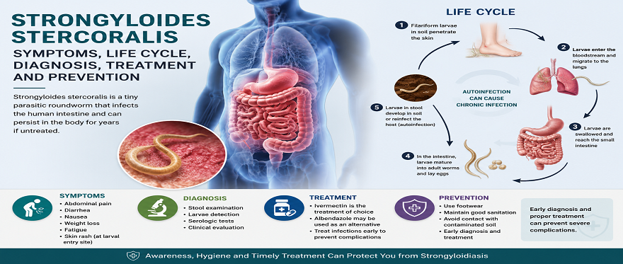 Strongyloides stercoralis: Symptoms, Life Cycle, Diagnosis, Treatment and Prevention