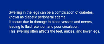 How to know if leg swelling is diabetes